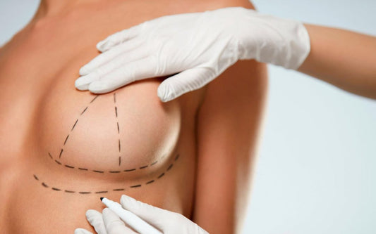 MAMOPLASTIA DE AUMENTO