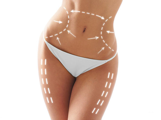 LIPO360 (LIPOESCULTURA)