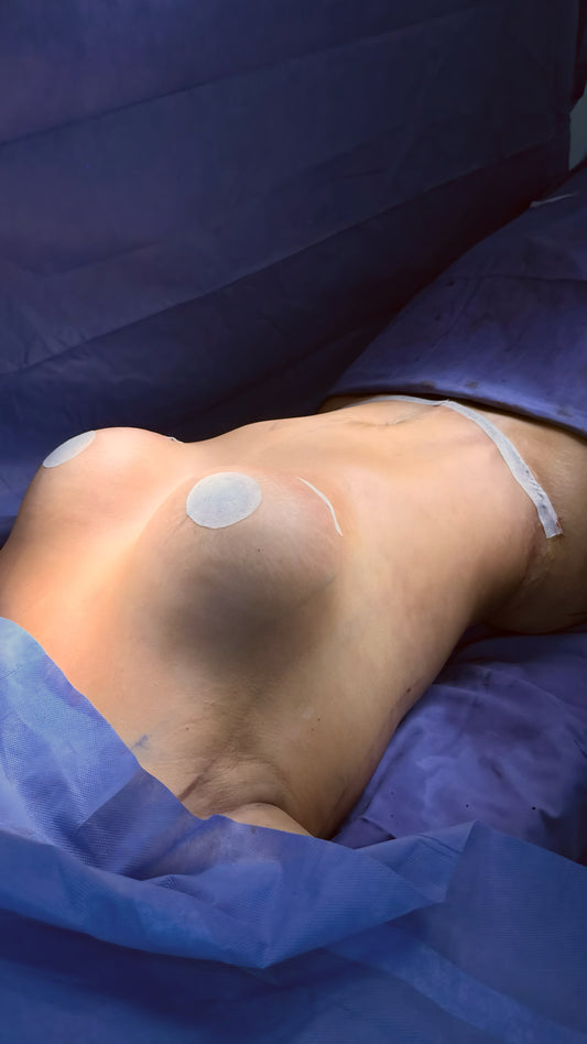 Precio de Mommy Makeover en Bogotá y Cartagena: por qué varía (25–40M en Colombia)