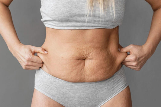 Precio de abdominoplastia en Bogotá y Cartagena: por qué varía y cuánto cuesta