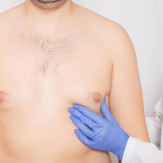 Doctor plástico examinando el pecho de un hombre, valoración ginecomastia en Cartagena